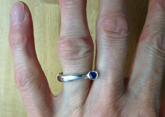 Speziallösung für veränderte Fingerknöchel 1 problemknoechel