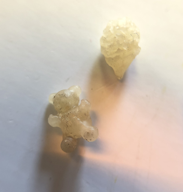 Wie der Igel seine Stacheln verlor 2 wachsformen